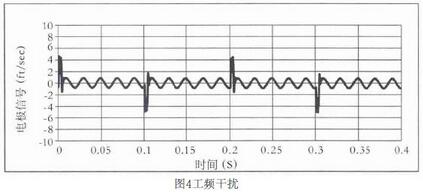 圖4工頻干擾
